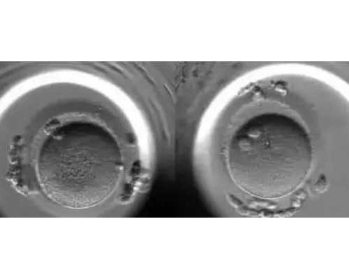 揭秘泰国第三代试管婴儿：国内借卵试管的明智选择