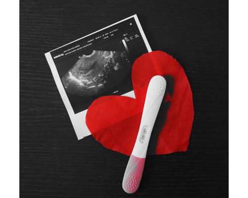 贵州助孕：解密柳州妇幼试管婴儿技术及成功经验