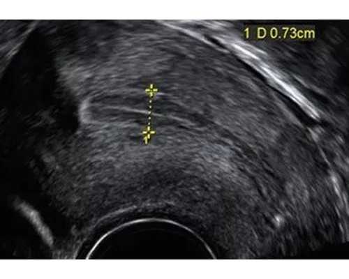 我的试管婴儿经历：点滴记录与孕育智慧