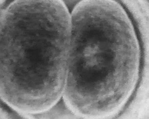 解析代生与助孕：二代试管婴儿费用及医院推荐